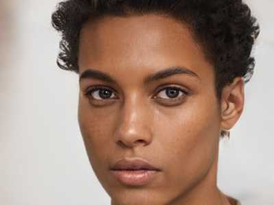 太原鼻部硅胶假体取出整容医院排名前五名单更新,太原新世纪医疗美容门诊部口碑更权威